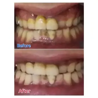 M渋谷店所属・Ｍ渋谷 ホワイトニングのエステ・リラクイメージ