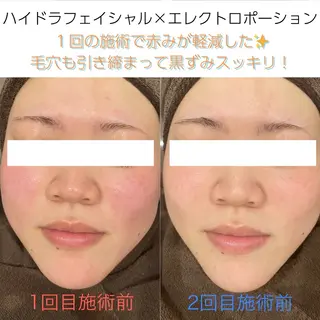 vary  clue MISAのエステ・リラクイメージ