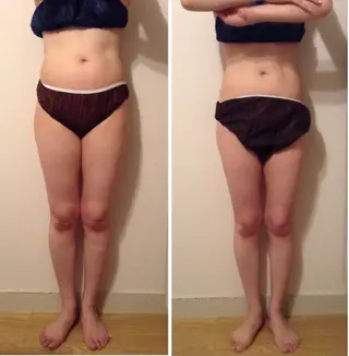 小尻・太もも痩せる エステルナボーテのエステ・リラクイメージ