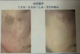 ボディケアサロン R ioNのエステ・リラクイメージ