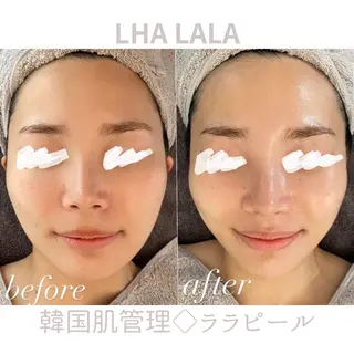 For...天王寺店 リンパ|ヘッドよもぎのエステ・リラクイメージ