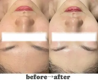 🌷U24毛穴エステ レイビス川崎🌷のエステ・リラクイメージ