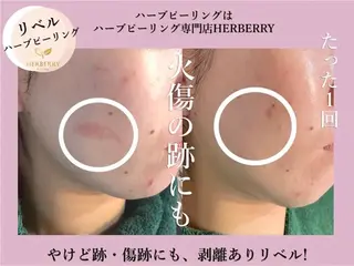 ハーブピーリング専門店HERBERRY難波心斎橋店所属・ハーブピーリング専門 HERBERRY冨永のエステ・リラクイメージ