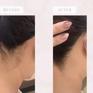 MINOA所属・MINOA 井上🌷のエステ・リラクイメージ