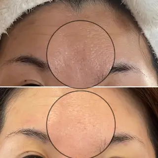 結果が出るスキンケア 肌質改善/まつパのエステ・リラクイメージ