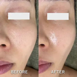 韓国美肌/肌質改善 【天神】yuiのエステ・リラクイメージ