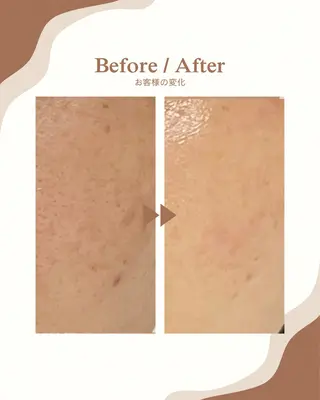 Rifuro 勝田台エステ所属・Rifuro勝田台 ララピール・毛穴洗浄のエステ・リラクイメージ