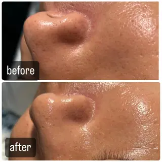 Gemini 　MIKIのエステ・リラクイメージ