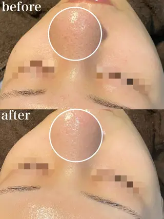 小顔の専門店　理想の小顔【リソウノコガオ】福島店所属・KOTO SALONのエステ・リラクイメージ