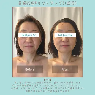 フェイシャルエステ Turquoiseのエステ・リラクイメージ
