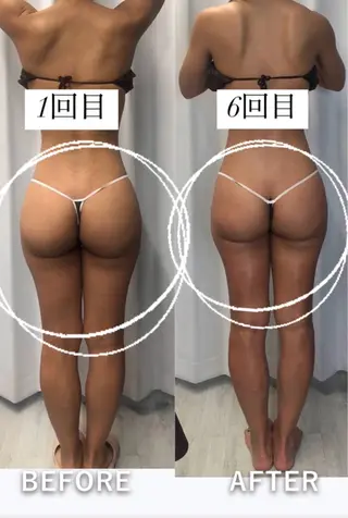 美容整体・塗る漢方・フェイシャルRechica所属・心斎橋痩身 美肌整体サロン💓のエステ・リラクイメージ