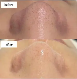 エステサロン-mignon-所属・mignon 脱毛/ ローマピンク/耳ツボのその他イメージ