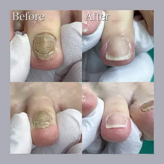 巻き爪補正店 大阪天王寺店のネイルデザイン