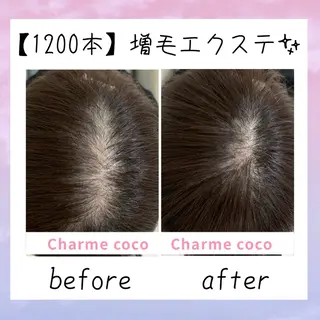 ショート 肌質改善Charme coco  増毛のエステ・リラクイメージ