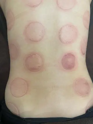 セルフエステエンリケ明石大久保店所属・夕希 毛穴と脱毛特化サロンのエステ・リラクイメージ