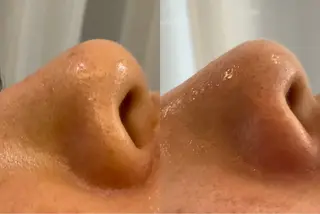 最速小顔・肌質管理 espoirマキのエステ・リラクイメージ