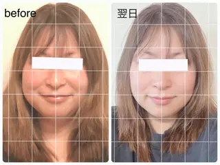 小顔矯正ドライヘッド Arincoのエステ・リラクイメージ