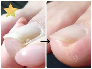 ネイル ピピネイルズ トモコのネイルデザイン