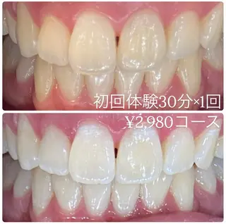 PLATINUM Beauty 横浜店所属・ホワイトニングルーム 横浜店のその他イメージ