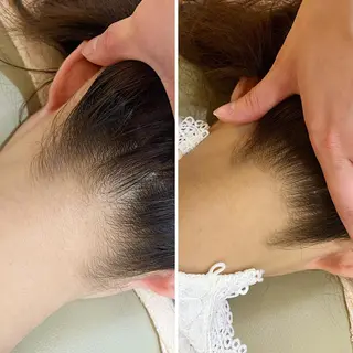 うなじ脱毛/美肌脱毛 LABELのエステ・リラクイメージ