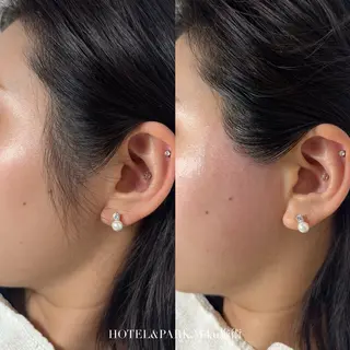 HOTEL&PARK Mikuワックス脱毛のエステ・リラクイメージ