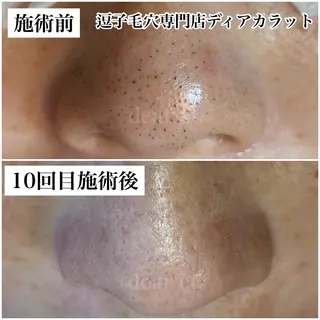 毛穴専門店　dear Ct.所属・毛穴専門店 ディアカラットのエステ・リラクイメージ