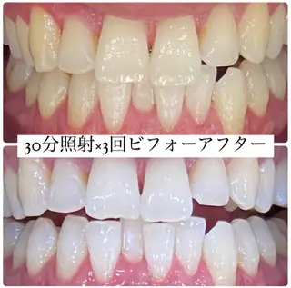 PLATINUM Beauty 横浜店所属・ホワイトニングルーム 横浜店のその他イメージ