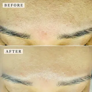 【産毛・眉毛ケア＆肌質改善サロン】＊BiBi＊beautysalon所属・眉･産毛専門BiBi 糸脱毛スレッティングのエステ・リラクイメージ