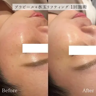 小顔美肌：ミアンカ 京阪モール本館1Fのエステ・リラクイメージ