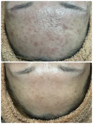 beautysalon  LINO所属・平日限定！お得！ 全メニュ¥5,500のエステ・リラクイメージ