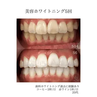 歯のセルフホワイトニング専門店GLOW（グロウ）所属・東区香椎歯のセルフホ ワイトニングGLOWのその他イメージ