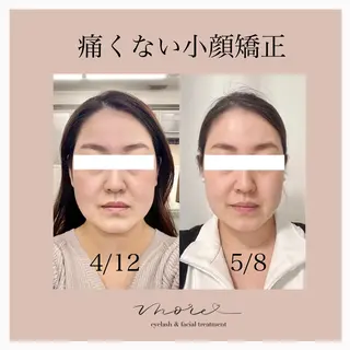 Eyelash salon MORE(モア)所属・安納 麻穂のエステ・リラクイメージ