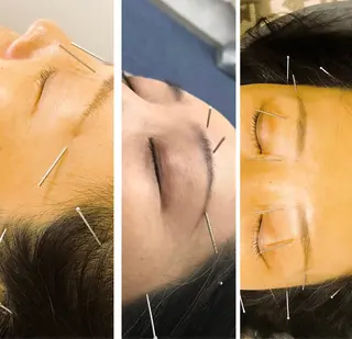 かすがい鍼灸院Re.heart所属・かすがい鍼灸院 Re.heartのエステ・リラクイメージ