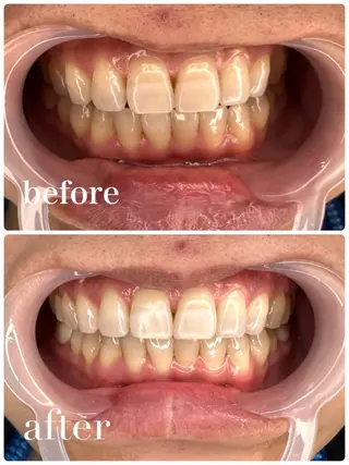 勝どきホワイトニング titti 旭花菜のその他イメージ