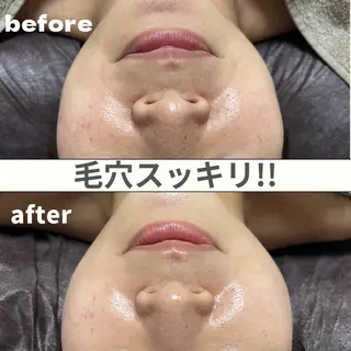 ReN所属・ReN エステサロンのエステ・リラクイメージ