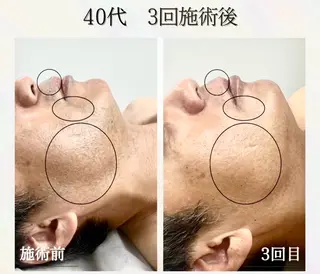 LED脱毛サロン【the 4】所属・元町駅1分 メンズ脱毛サロンのエステ・リラクイメージ