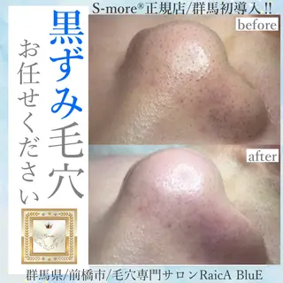 毛穴専門サロン ライカブルーのエステ・リラクイメージ