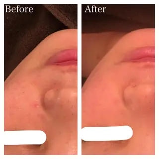 ミディアム カラー ネイル マツエク・マツパ ニキビ跡専門サロン Ａｉｎａのエステ・リラクイメージ