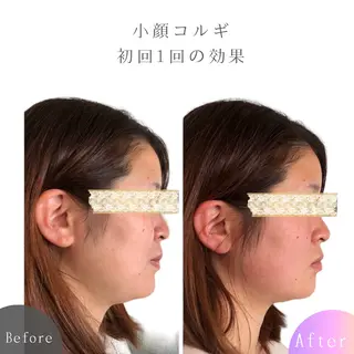 LEA LEA -レアレア-のエステ・リラクイメージ