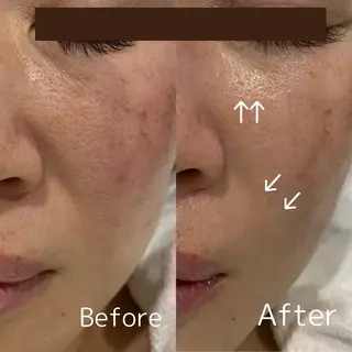 Del'm豊橋所属・豊橋De'Im 安部のエステ・リラクイメージ