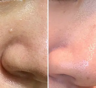 メナード 天神 やまさきのエステ・リラクイメージ