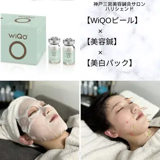 美容鍼・小顔矯正 ハリシェンドのエステ・リラクイメージ