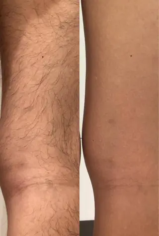 メンズ 脱毛専門サロンElixir所属・脱毛専門サロン ELIXIR館林店のエステ・リラクイメージ