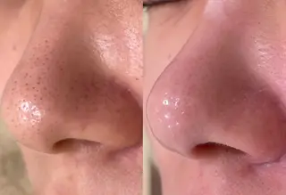 Anhamia.所属・艶肌ワックス×ピーリ ングAnhamia.のエステ・リラクイメージ