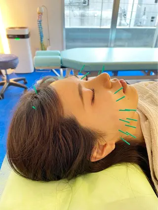 小顔美容鍼専門サロン 渋谷YZのエステ・リラクイメージ