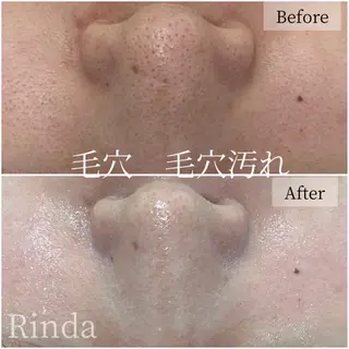 ブライダル痩身×脱毛 尼崎駅前サロンのエステ・リラクイメージ