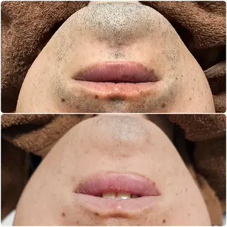 メンズ Iryアイリー所属・Iry アイリーのエステ・リラクイメージ