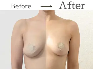 全身整えるバスト ケア【cany】のエステ・リラクイメージ