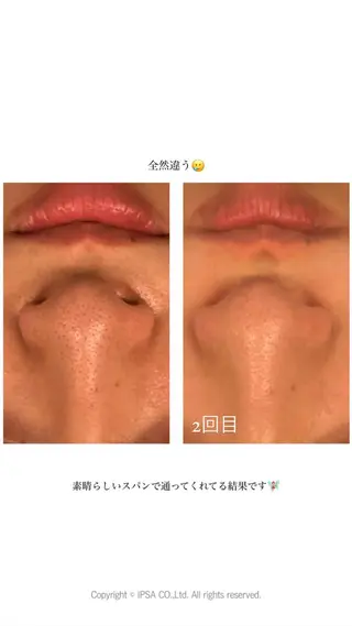 BACI STYLE所属・寧♡ 美肌小顔・ボディケアのエステ・リラクイメージ