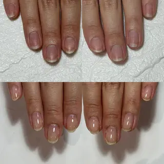 ネイル 自爪育成・巻き爪 補正講師　津蔵のネイルデザイン